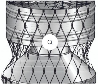 Stainless Steel Bird Mesh Chimney Cover